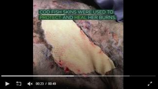 Vissenhuid als oplossing bij brandwonden bij dieren